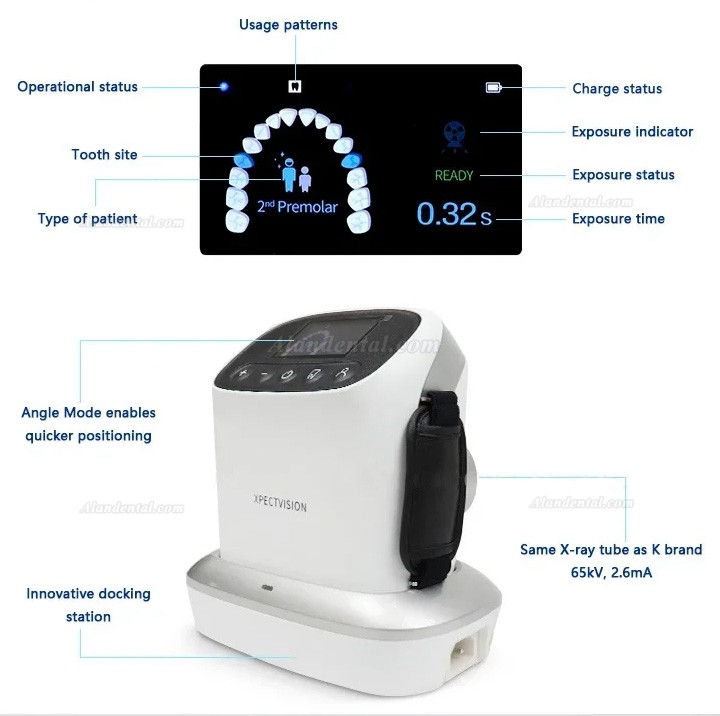 Dental Portable Dental X-Ray Machine Handheld High Frequency X Ray Unit XVbeam2000